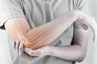 Científicos rusos crean el primer gel para regenerar huesos